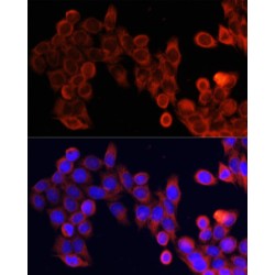 Serine/Threonine-Protein Kinase MTOR (MTOR) Antibody