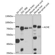 abx005992