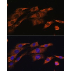 Acetylcholinesterase (AChE) Antibody