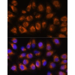 Acetylcholinesterase (AChE) Antibody