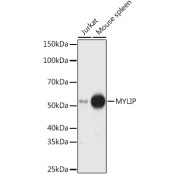 Western blot analysis of various lysates using MYLIP Antibody at 1/1000 dilution. Secondary antibody: HRP-conjugated Goat anti-Rabbit IgG (H+L) at 1/10000 dilution. Lysates/proteins: 25 µg per lane. Blocking buffer: 3% nonfat dry milk in TBST. Exposure time: 30s.