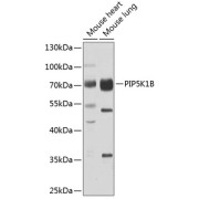 Western blot analysis of various lysates using PIP5K1B Antibody at 1/1000 dilution. Secondary antibody: HRP-conjugated Goat anti-Rabbit IgG (H+L) at 1/10000 dilution. Lysates/proteins: 25 µg per lane. Blocking buffer: 3% nonfat dry milk in TBST. Exposure time: 10s.