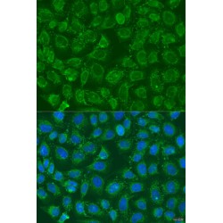Phosphatidylinositol-4-Phosphate 5-Kinase Type 1 Beta (PIP5K1B) Antibody