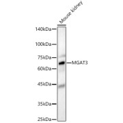 Western blot analysis of lysates from Mouse kidney, using MGAT3 Antibody at 1/1000 dilution. Secondary antibody: HRP-conjugated Goat anti-Rabbit IgG (H+L) at 1/10000 dilution. Lysates/proteins: 25 µg per lane. Blocking buffer: 3% nonfat dry milk in TBST. Exposure time: 180s.