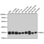 Western blot analysis of various lysates using PRPS1 Antibody at 1/1000 dilution. Secondary antibody: HRP-conjugated Goat anti-Rabbit IgG (H+L) at 1/10000 dilution. Lysates/proteins: 25 µg per lane. Blocking buffer: 3% nonfat dry milk in TBST. Exposure time: 40s.