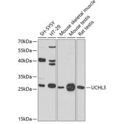 Western blot analysis of various lysates using UCHL3 Antibody at 1/1000 dilution. Secondary antibody: HRP-conjugated Goat anti-Rabbit IgG (H+L) at 1/10000 dilution. Lysates/proteins: 25 µg per lane. Blocking buffer: 3% nonfat dry milk in TBST. Exposure time: 90s.