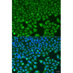 Branched-Chain Alpha-Ketoacid Dehydrogenase Kinase (BCKDK) Antibody