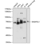 Western blot analysis of various lysates using BAIAP2L1 Antibody at 1/3000 dilution. Secondary antibody: HRP-conjugated Goat anti-Rabbit IgG (H+L) at 1/10000 dilution. Lysates/proteins: 25 µg per lane. Blocking buffer: 3% nonfat dry milk in TBST. Exposure time: 5s.