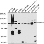 Western blot analysis of various lysates using HPSE2 Antibody at 1/1000 dilution. Secondary antibody: HRP-conjugated Goat anti-Rabbit IgG (H+L) at 1/10000 dilution. Lysates/proteins: 25 µg per lane. Blocking buffer: 3% nonfat dry milk in TBST. Exposure time: 90s.