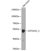 Western blot analysis of lysates from rat brain, using GTF2H2C 2 Antibody at 1/1000 dilution. Secondary antibody: HRP-conjugated Goat anti-Rabbit IgG (H+L) at 1/10000 dilution. Lysates/proteins: 25 µg per lane. Blocking buffer: 3% nonfat dry milk in TBST. Exposure time: 90s.