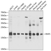 Western blot analysis of various lysates using RNF5 Antibody at 1/1000 dilution. Secondary antibody: HRP-conjugated Goat anti-Rabbit IgG (H+L) at 1/10000 dilution. Lysates/proteins: 25 µg per lane. Blocking buffer: 3% nonfat dry milk in TBST. Exposure time: 30s.