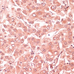 Ring Finger Protein 5 (RNF5) Antibody