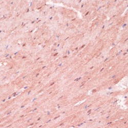Ring Finger Protein 5 (RNF5) Antibody