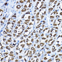6-Phosphogluconolactonase (PGLS) Antibody
