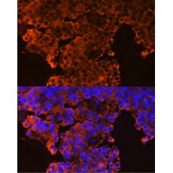Growth Hormone Releasing Hormone Receptor (GHRHR) Antibody