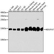Western blot analysis of various lysates using [KO Validated] NDUFA7 Antibody at 1/1000 dilution. Secondary antibody: HRP-conjugated Goat anti-Rabbit IgG (H+L) at 1/10000 dilution. Lysates/proteins: 25 µg per lane. Blocking buffer: 3% nonfat dry milk in TBST. Exposure time: 30s.