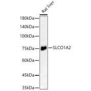 Western blot analysis of lysates from Rat liver, using SLCO1A2 Antibody at 1/3000 dilution. Secondary antibody: HRP-conjugated Goat anti-Rabbit IgG (H+L) at 1/10000 dilution. Lysates/proteins: 25 µg per lane. Blocking buffer: 3% nonfat dry milk in TBST. Exposure time: 180s.