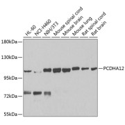 Western blot analysis of various lysates using PCDHA12 Antibody at 1/1000 dilution. Secondary antibody: HRP-conjugated Goat anti-Rabbit IgG (H+L) at 1/10000 dilution. Lysates/proteins: 25 µg per lane. Blocking buffer: 3% nonfat dry milk in TBST. Exposure time: 90s.