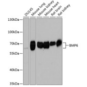 Western blot analysis of various lysates using BMP6 Antibody at 1/1000 dilution. Secondary antibody: HRP-conjugated Goat anti-Rabbit IgG (H+L) at 1/10000 dilution. Lysates/proteins: 25 µg per lane. Blocking buffer: 3% nonfat dry milk in TBST. Exposure time: 10s.