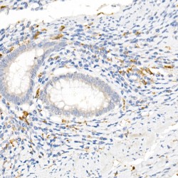 Scavenger Receptor Cysteine-Rich Type 1 Protein M130 (CD163) Antibody