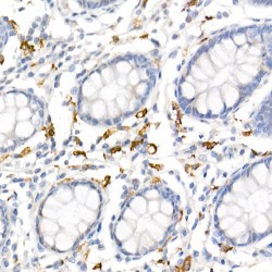 Scavenger Receptor Cysteine-Rich Type 1 Protein M130 (CD163) Antibody