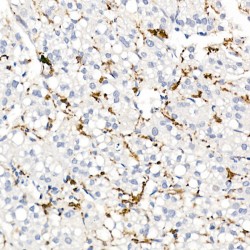 Scavenger Receptor Cysteine-Rich Type 1 Protein M130 (CD163) Antibody