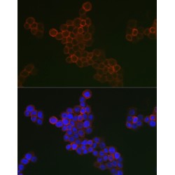 Scavenger Receptor Cysteine-Rich Type 1 Protein M130 (CD163) Antibody