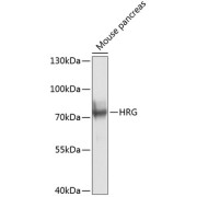 Western blot analysis of lysates from mouse pancreas, using HRG Antibody at 1/1000 dilution. Secondary antibody: HRP-conjugated Goat anti-Rabbit IgG (H+L) at 1/10000 dilution. Lysates/proteins: 25 µg per lane. Blocking buffer: 3% nonfat dry milk in TBST. Exposure time: 1s.