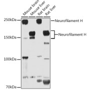 Western blot analysis of various lysates using Neurofilament H Antibody at 1/1000 dilution. Secondary antibody: HRP-conjugated Goat anti-Rabbit IgG (H+L) at 1/10000 dilution. Lysates/proteins: 25 µg per lane. Blocking buffer: 3% nonfat dry milk in TBST. Exposure time: 30s.