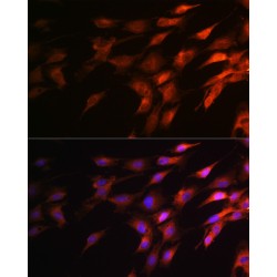 Neurofilament Heavy Polypeptide (NEFH) Antibody
