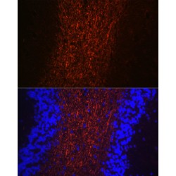 Neurofilament Heavy Polypeptide (NEFH) Antibody