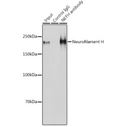 Neurofilament Heavy Polypeptide (NEFH) Antibody