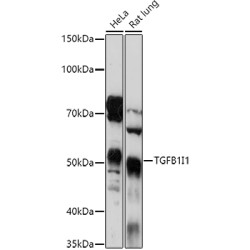 Transforming Growth Factor Beta 1 Induced Transcript 1 (TGFB1I1) Antibody