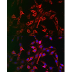 Low Density Lipoprotein Receptor Related Protein 5 (LRP5) Antibody