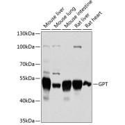 Western blot analysis of various lysates using GPT Antibody at 1/1000 dilution. Secondary antibody: HRP-conjugated Goat anti-Rabbit IgG (H+L) at 1/10000 dilution. Lysates/proteins: 25 µg per lane. Blocking buffer: 3% nonfat dry milk in TBST. Exposure time: 90s.