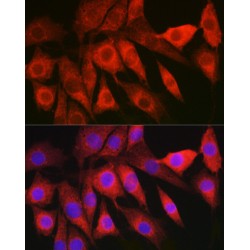 Hepatitis B Virus X Interacting Protein (LAMTOR5) Antibody