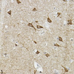 Endothelial PAS Domain-Containing Protein 1 (EPAS1) Antibody