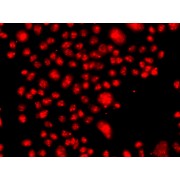 Immunofluorescence analysis of A549 cells using FANCM Antibody.Secondary antibody: Cy3-conjugated Goat anti-Rabbit IgG (H+L) at 1/500 dilution.