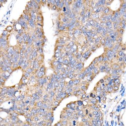 NADH Ubiquinone Oxidoreductase Core Subunit V1 (NDUFV1) Antibody