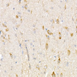 NADH Ubiquinone Oxidoreductase Core Subunit V1 (NDUFV1) Antibody
