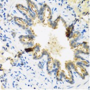 Immunohistochemistry analysis of paraffin-embedded Rat lung using DEFB4A Antibody at dilution of 1/100 (40x lens). Microwave antigen retrieval performed in 0.01 M PBS Buffer (pH 7.2) prior to IHC staining.