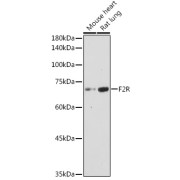 Western blot analysis of various lysates using F2R Antibody at 1/1000 dilution. Secondary antibody: HRP-conjugated Goat anti-Rabbit IgG (H+L) at 1/10000 dilution. Lysates/proteins: 25 µg per lane. Blocking buffer: 3% nonfat dry milk in TBST. Exposure time: 180s.