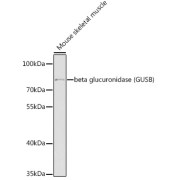Western blot analysis of lysates from mouse skeletal muscle, using beta glucuronidase (GUSB) Antibody at 1/1000 dilution. Secondary antibody: HRP-conjugated Goat anti-Rabbit IgG (H+L) at 1/10000 dilution. Lysates/proteins: 25 µg per lane. Blocking buffer: 3% nonfat dry milk in TBST. Exposure time: 90s.