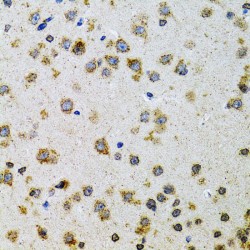 Prodynorphin (PDYN) Antibody