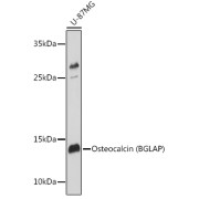 Western blot analysis of lysates from U-87MG cells, using Osteocalcin (BGLAP) Antibody at 1/1000 dilution. Secondary antibody: HRP-conjugated Goat anti-Rabbit IgG (H+L) at 1/10000 dilution. Lysates/proteins: 25 µg per lane. Blocking buffer: 3% nonfat dry milk in TBST. Exposure time: 1s.