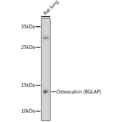 Osteocalcin (BGLAP) Antibody