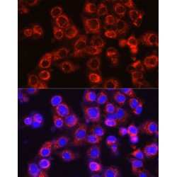 Osteocalcin (BGLAP) Antibody