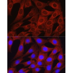 Osteocalcin (BGLAP) Antibody