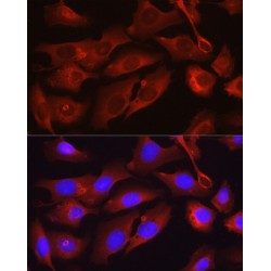 Osteocalcin (BGLAP) Antibody
