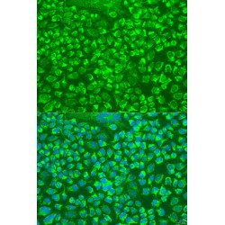 Granzyme A (GZMA) Antibody